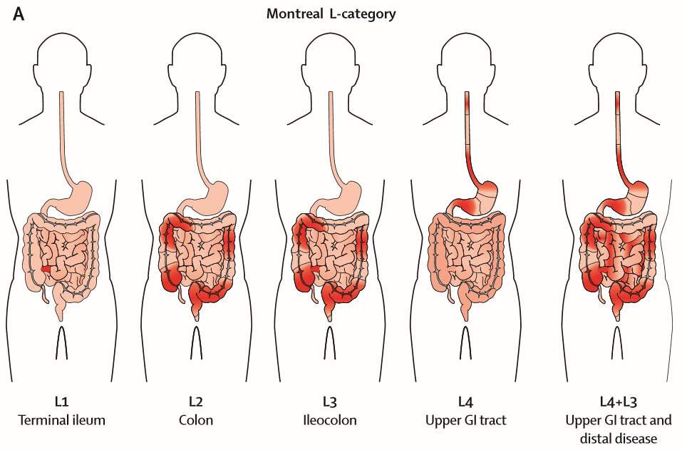 2020-04-29 01-54-49 Microsoft Edge-min.png